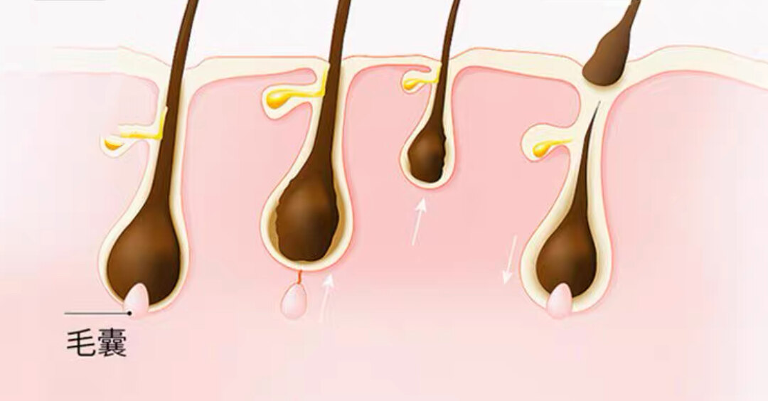 毛囊炎_症状表现_治疗方式 - 好大夫在线