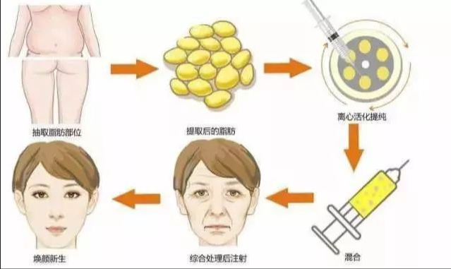 圖文圖片
