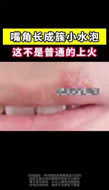 視頻封面