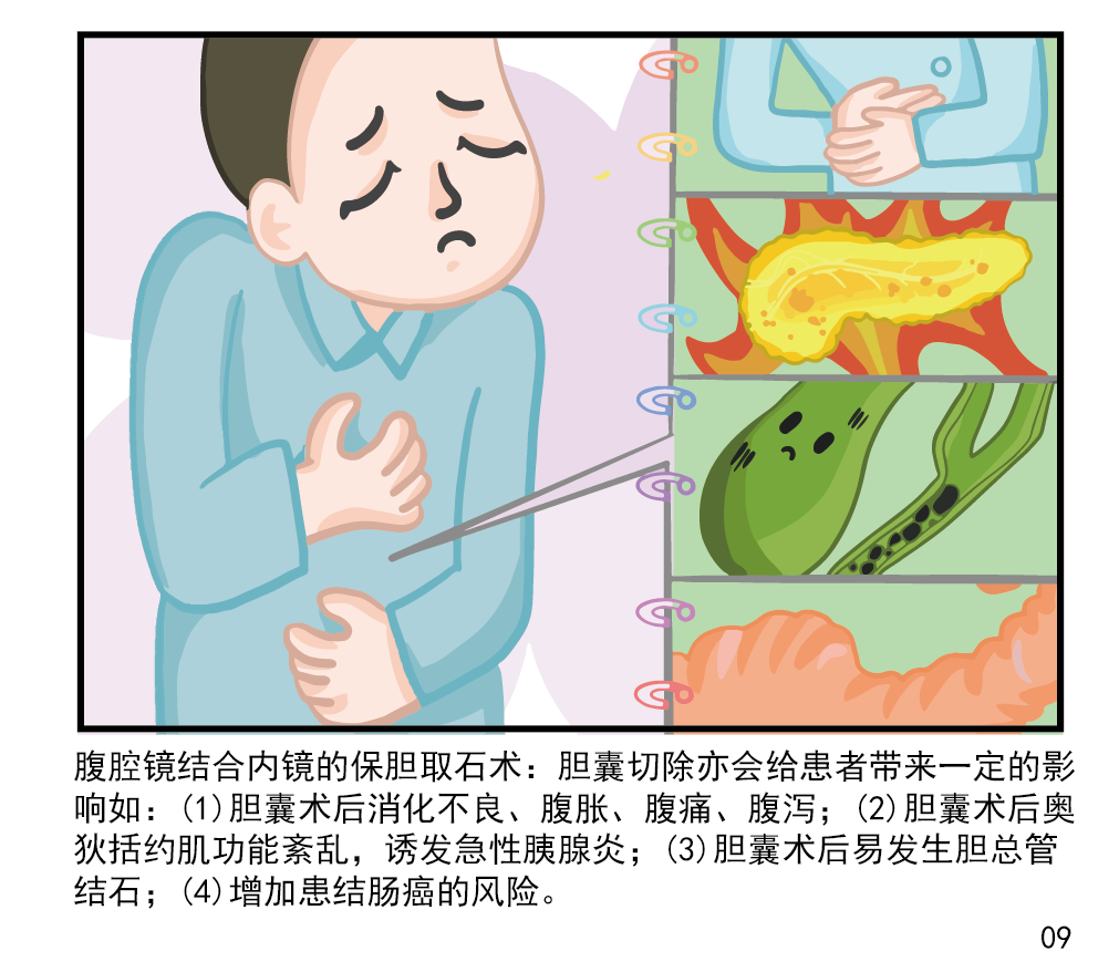 胆囊手术方式的演变及优缺点_胆囊切除术 好大夫在线