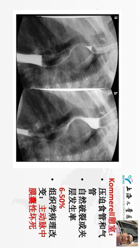 視頻封面