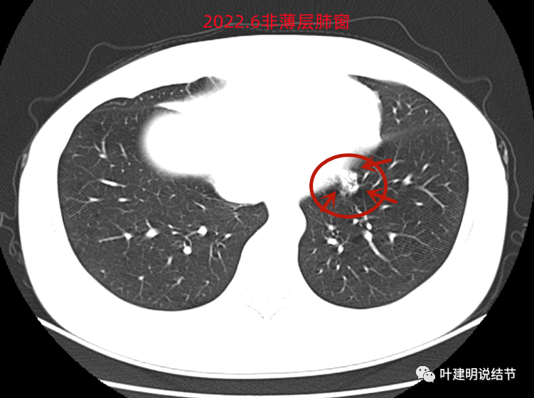 原武警总医院代问诊CT加急的简单介绍
