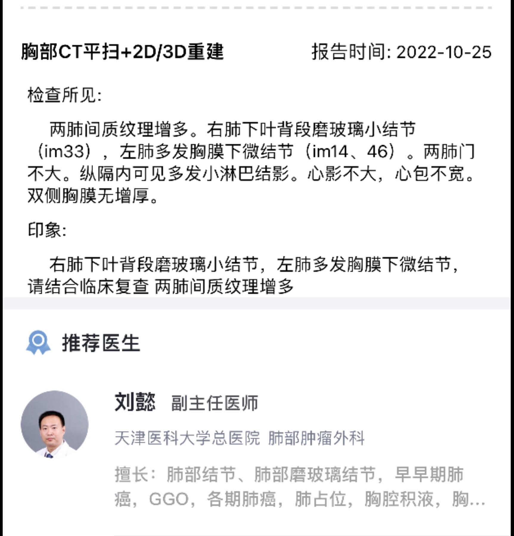 刘懿博士说肺癌（四七二三）胸片考虑乳头影，CT发现真有肺结节_肺癌_肺癌检查 - 好大夫在线