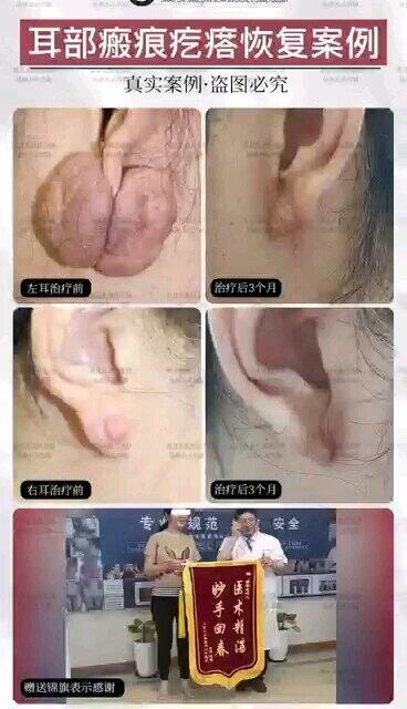 視頻封面