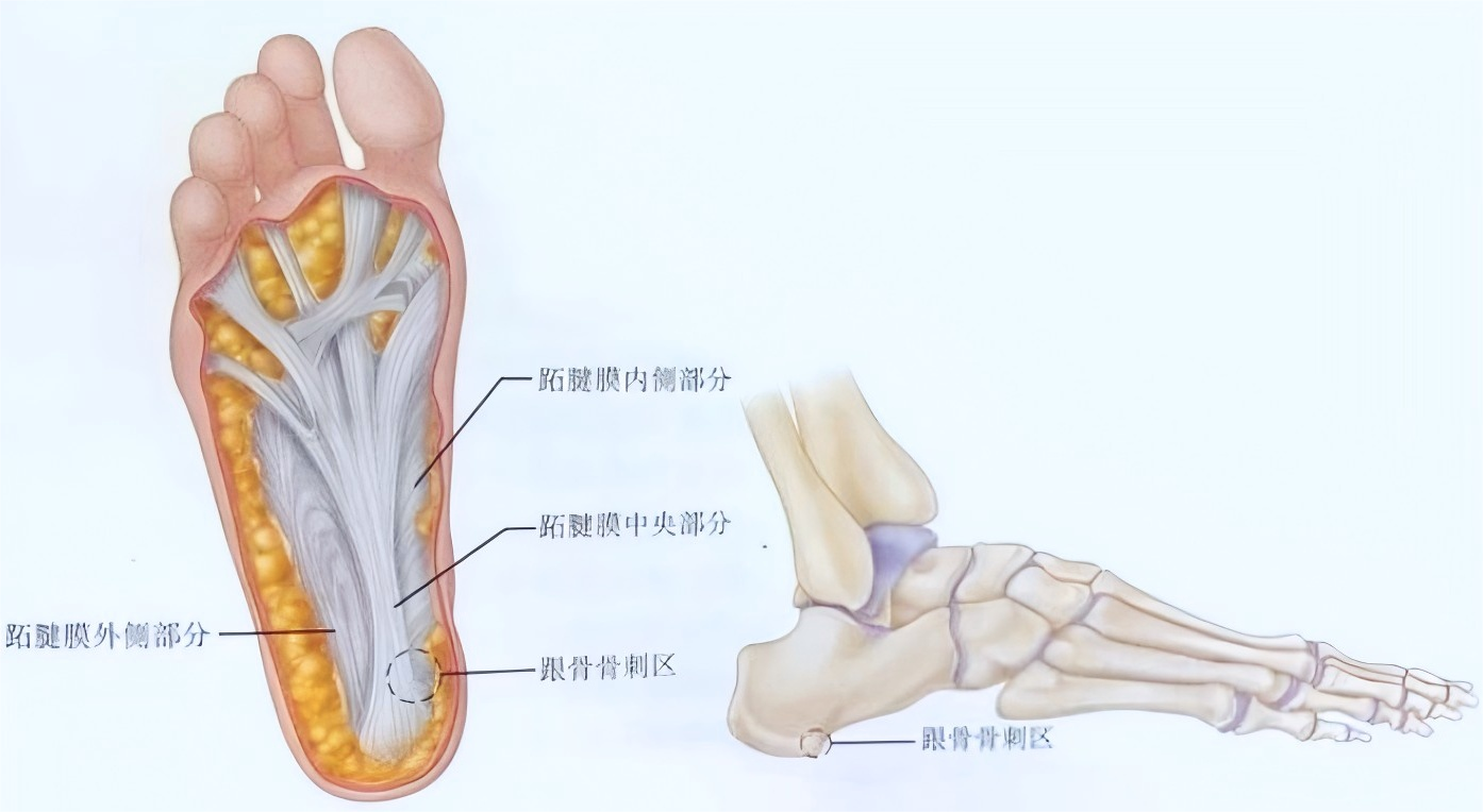 科普文献:脚底筋膜与脚痛