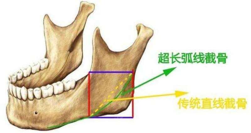 圖文圖片