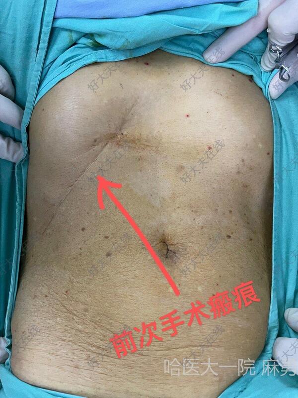 圖文圖片