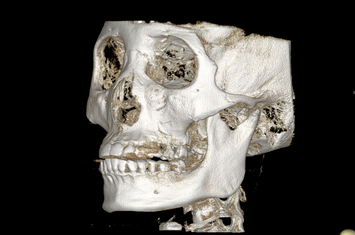 高低不对称,前后不对称,咬合水平面是否倾斜,下颏有没有高低不对称