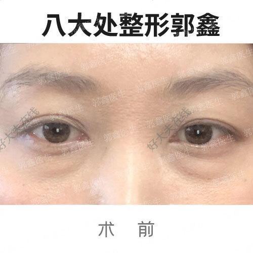 圖文圖片