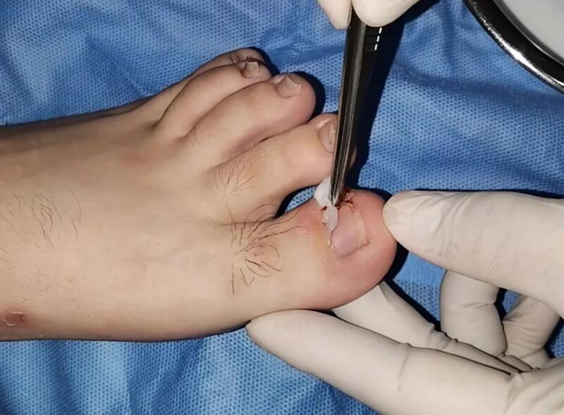 圖文圖片