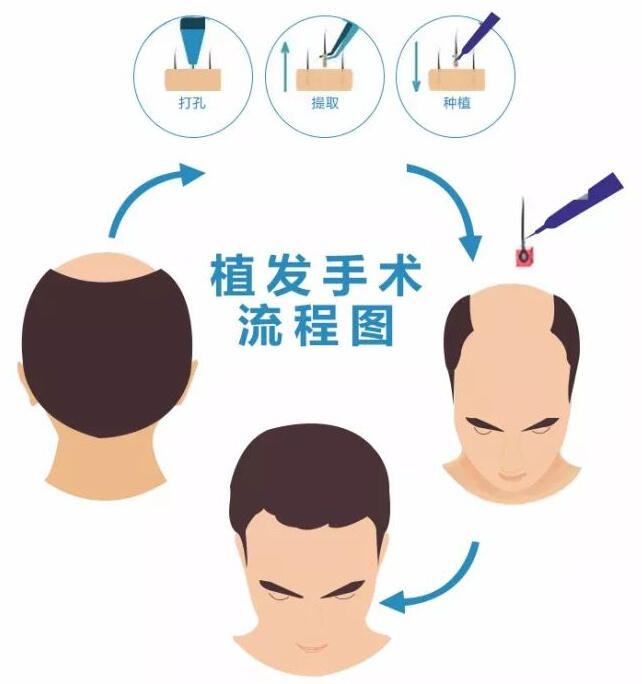 圖文圖片