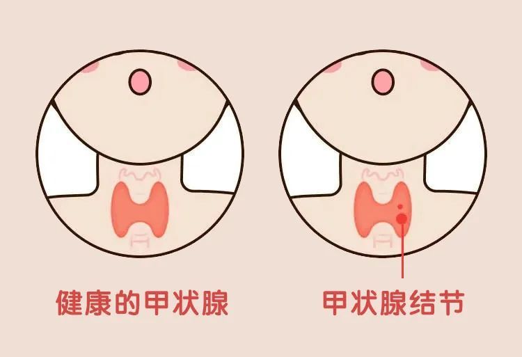 圖文圖片
