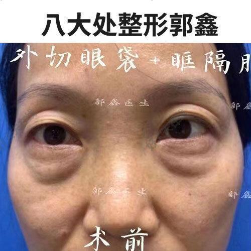 圖文圖片