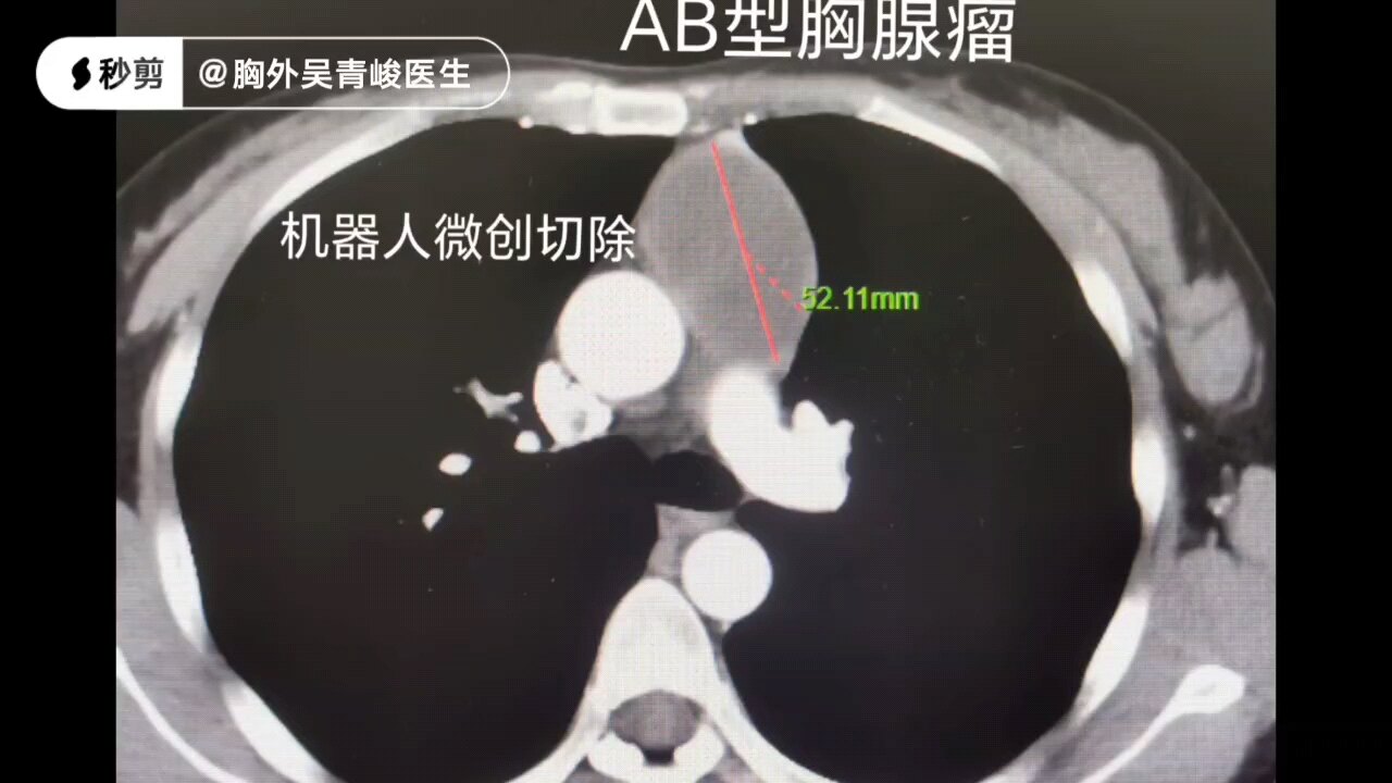 默认图片