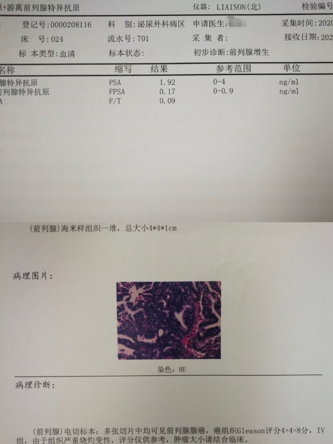 psa升高怎么办？