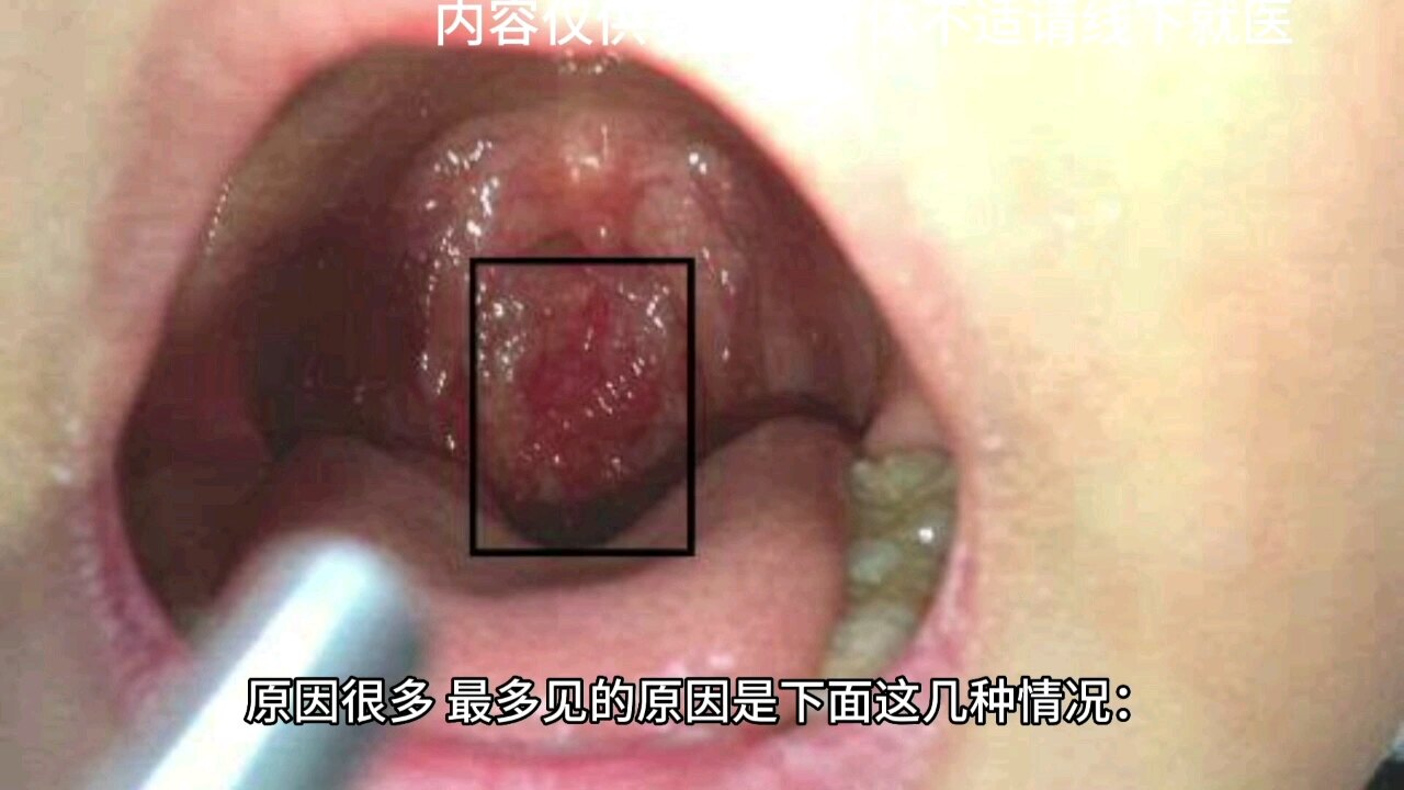 视频海报