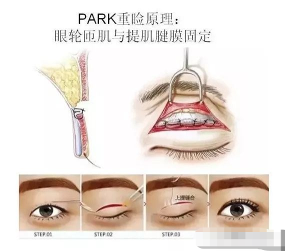 圖文圖片