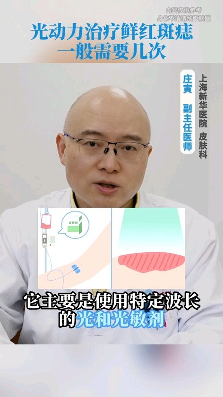 視頻封面