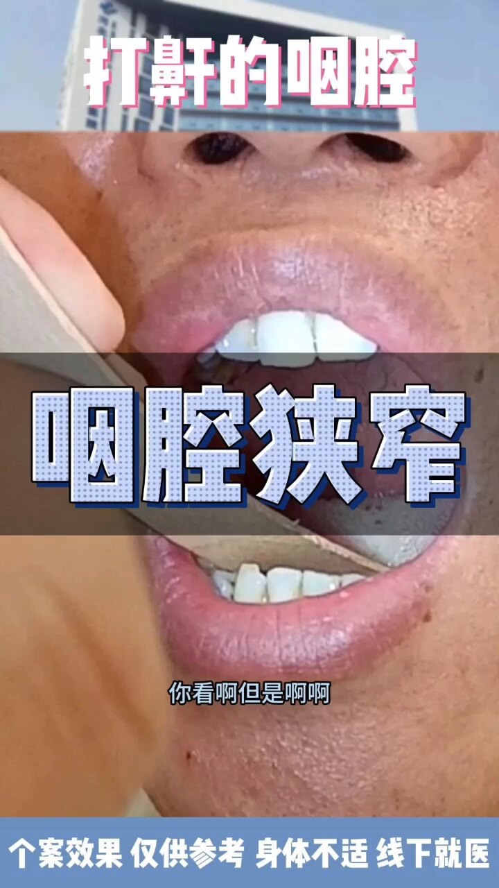 默认图片