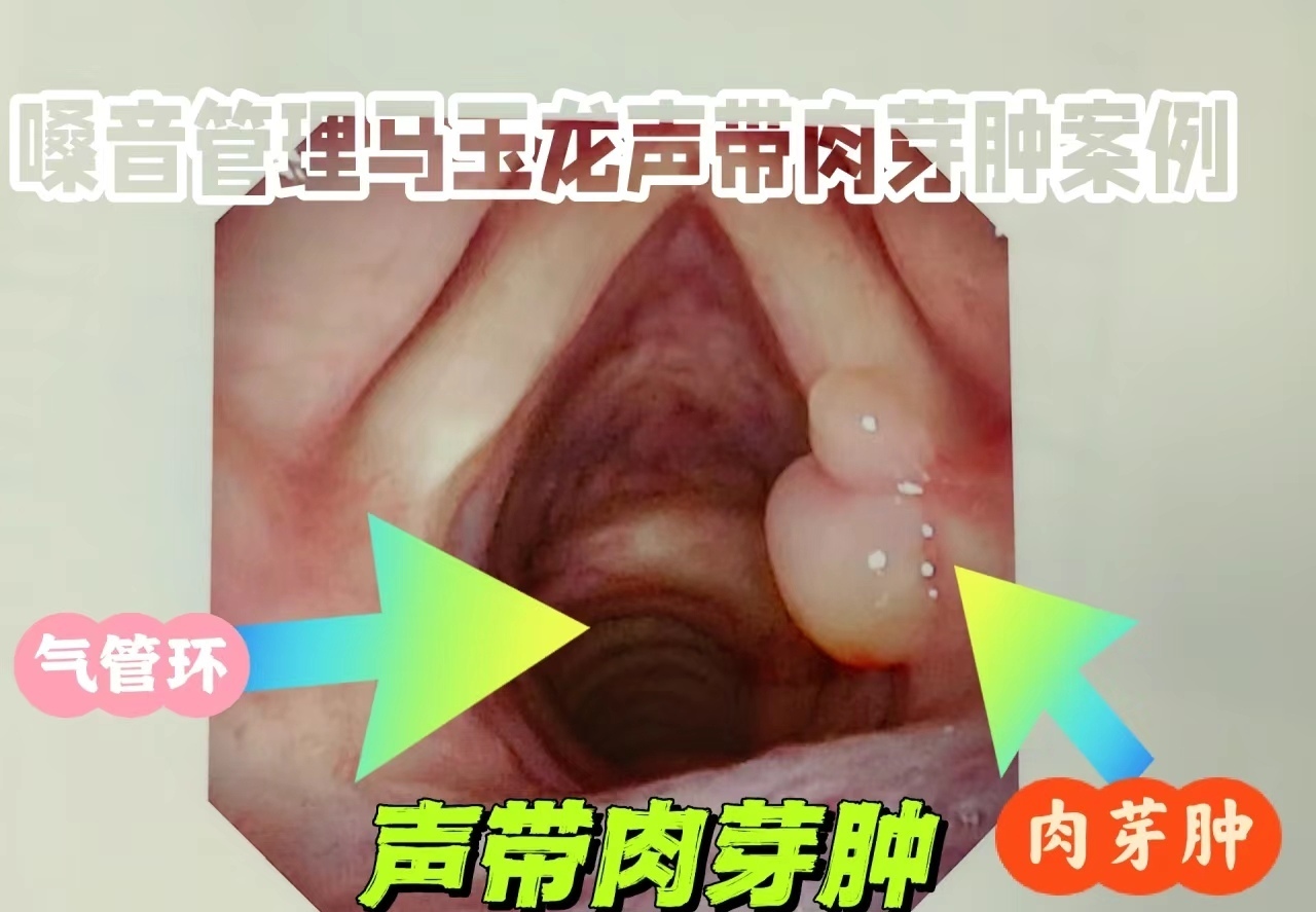圖文圖片