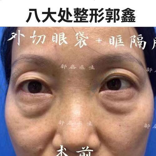 圖文圖片