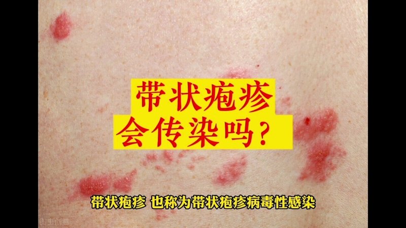 視頻封面