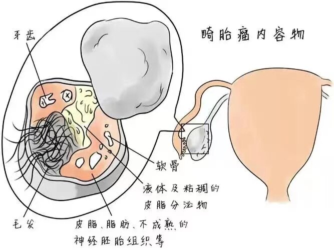 图文图片