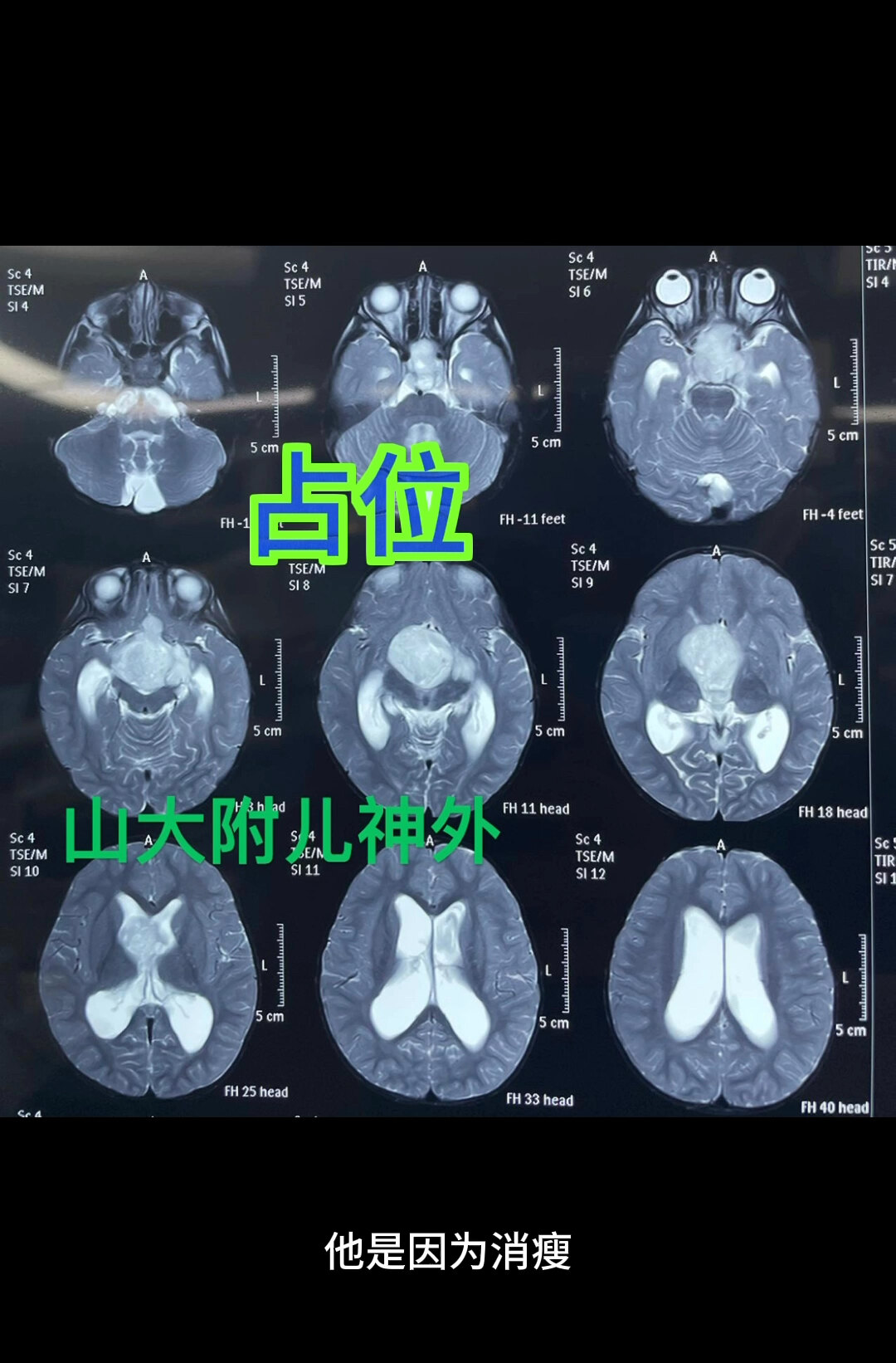 默认图片