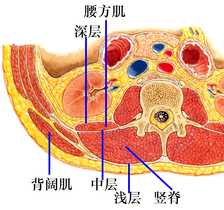 急性骨质疏松性椎体压缩性骨折合并胸腰筋膜损伤