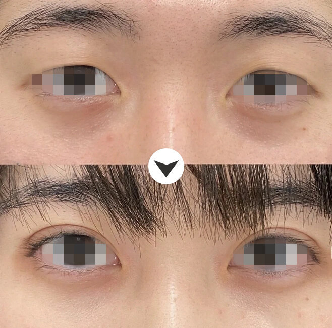 圖文圖片
