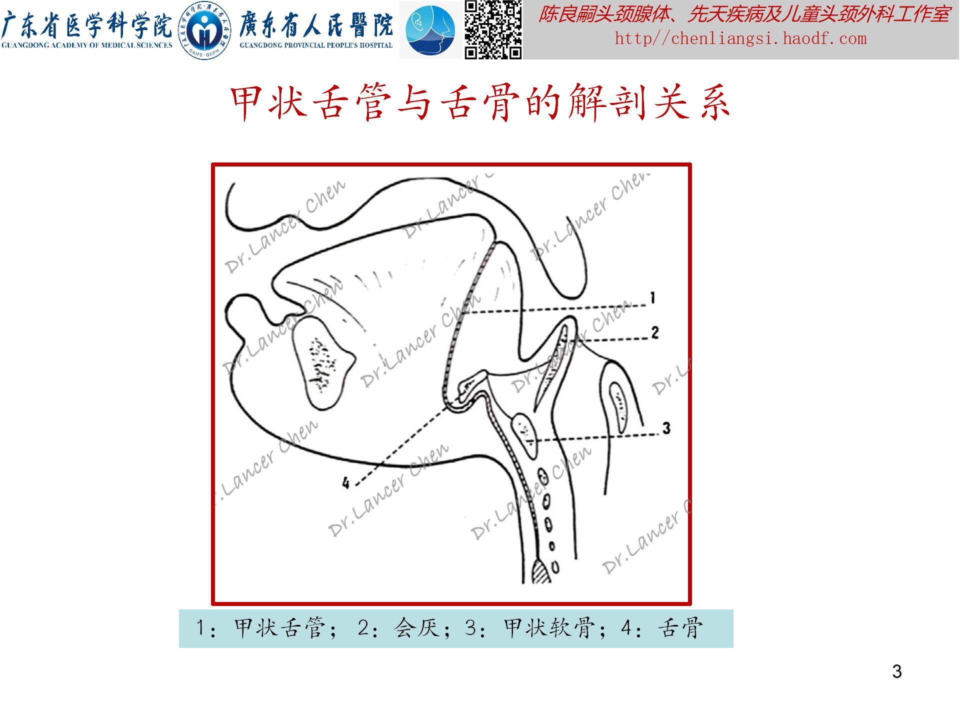 20240621：医学科普——百密一疏：舌骨后间隙的忽略，可导致甲状舌管囊肿术后复发_03.jpg