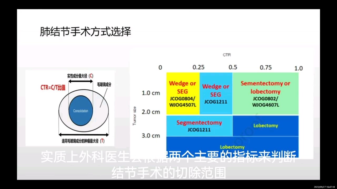 默认图片