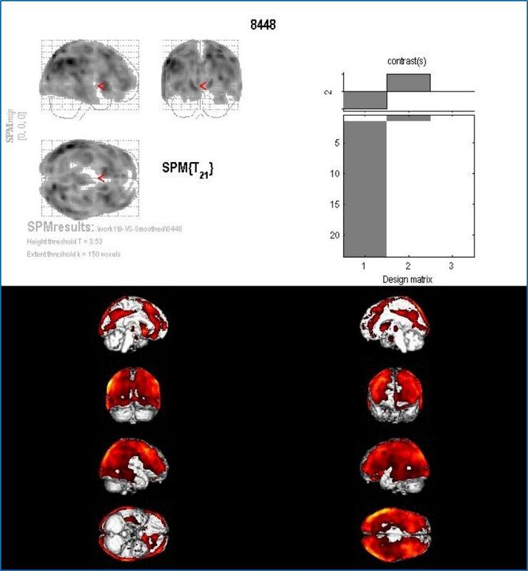 PET-CT.jpg