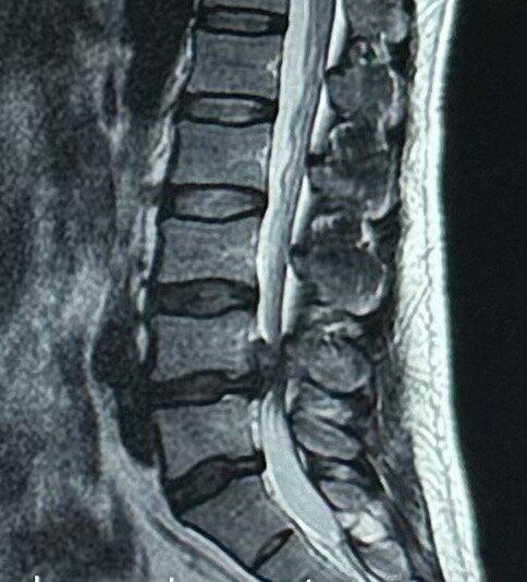 腰椎间盘突出趴着睡好 24YBAGR8ba-AE4MkAAC2PXUCazs448_800_800_1.jpg?24b4