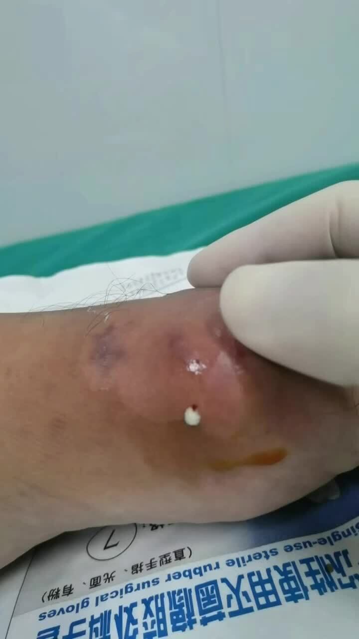 視頻封面