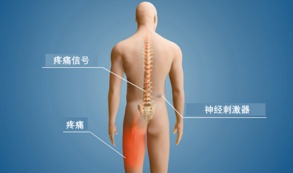 圖文圖片