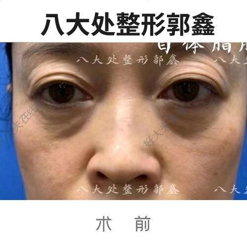圖文圖片