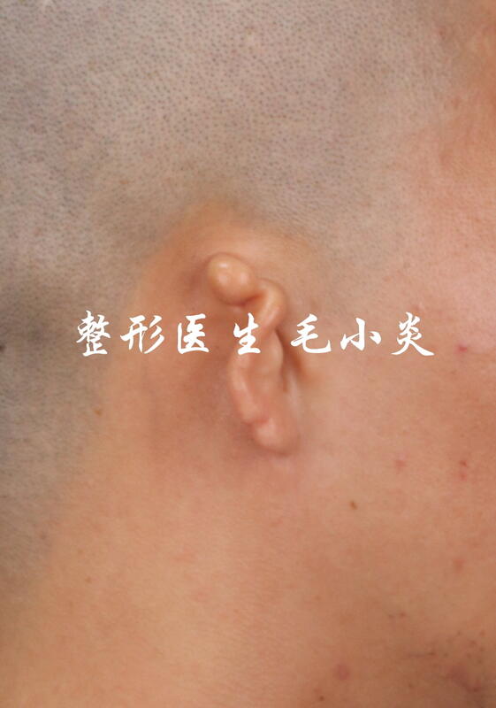 圖文圖片