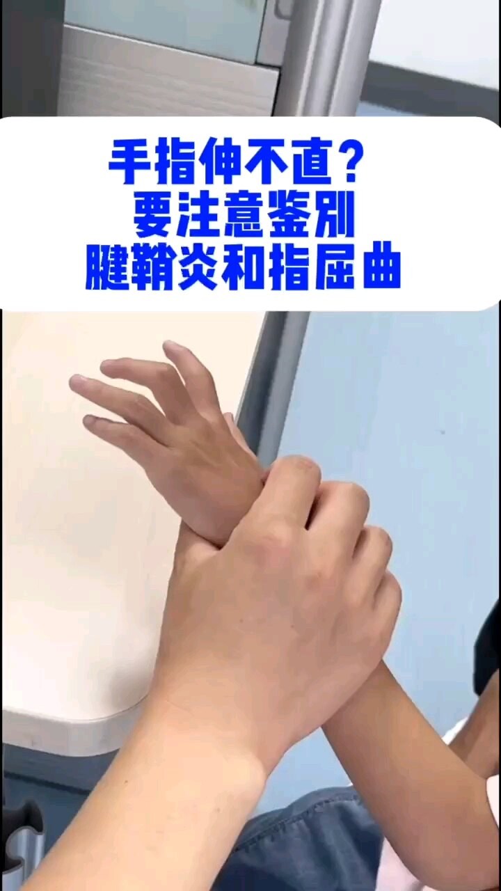 默认图片