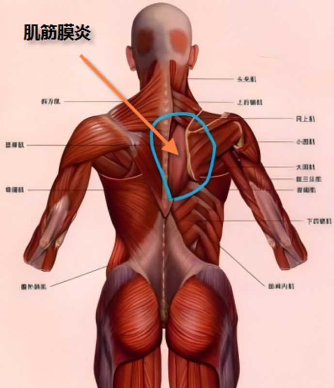 圖文圖片