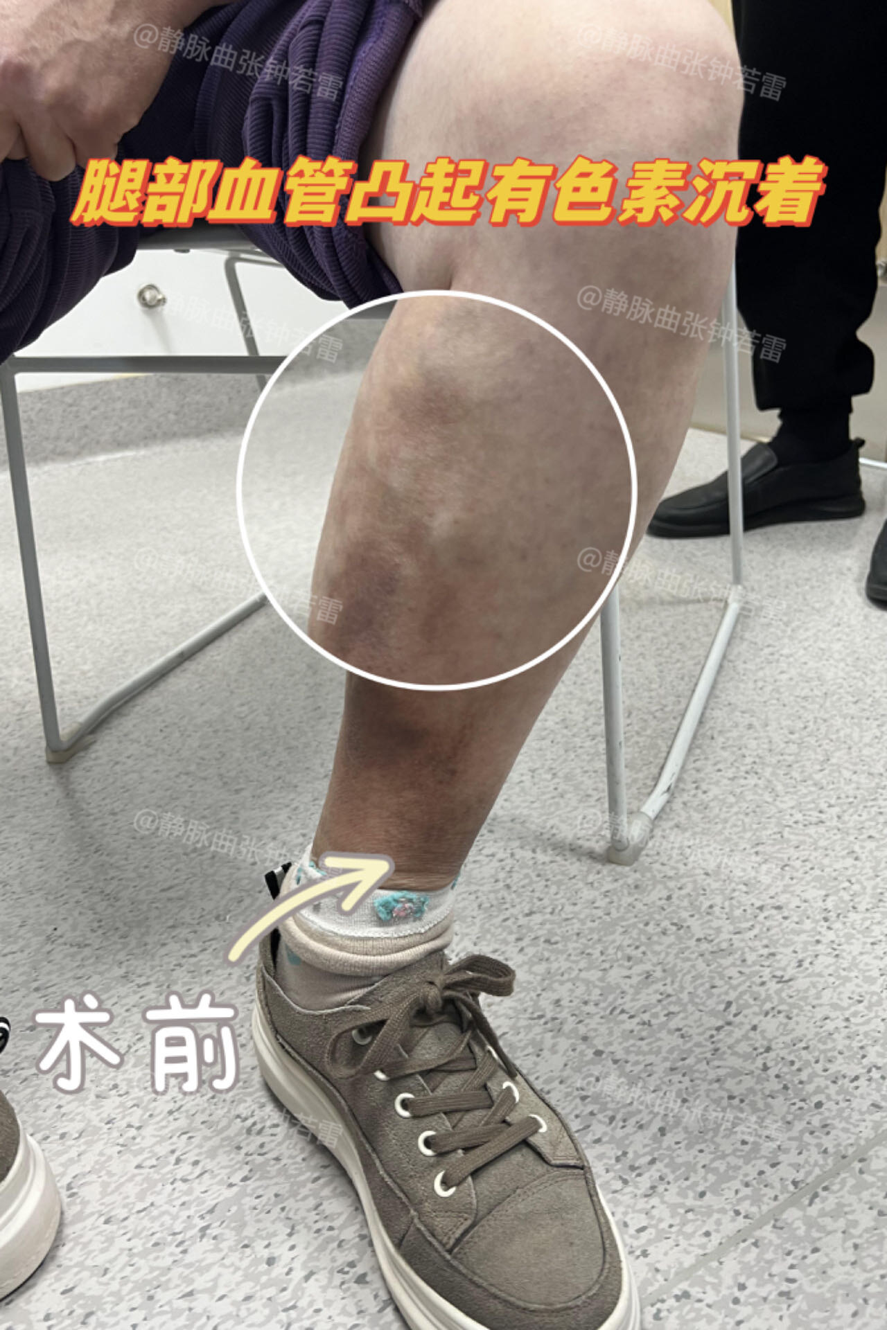 圖文圖片