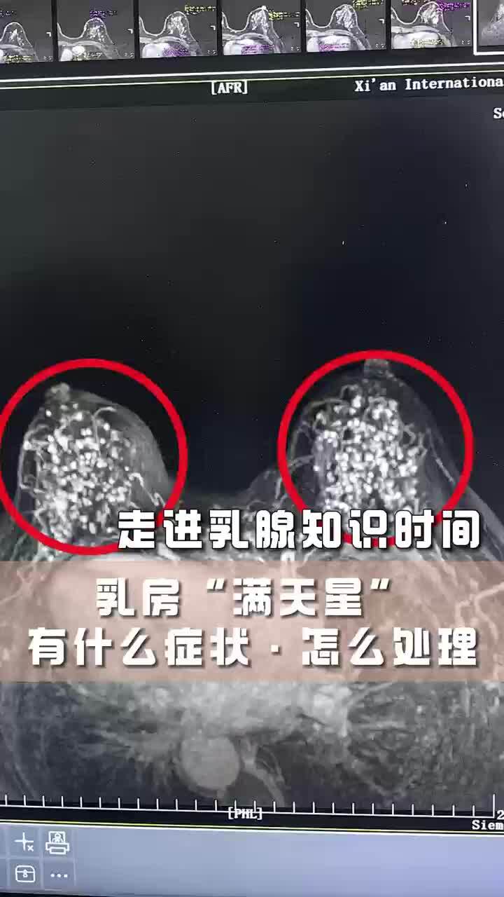 視頻封面