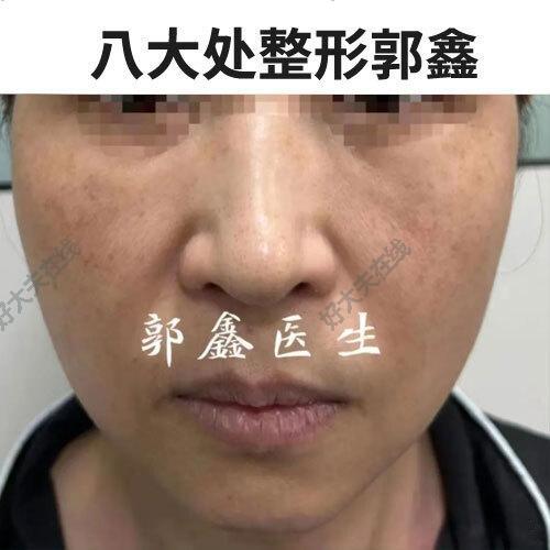 圖文圖片