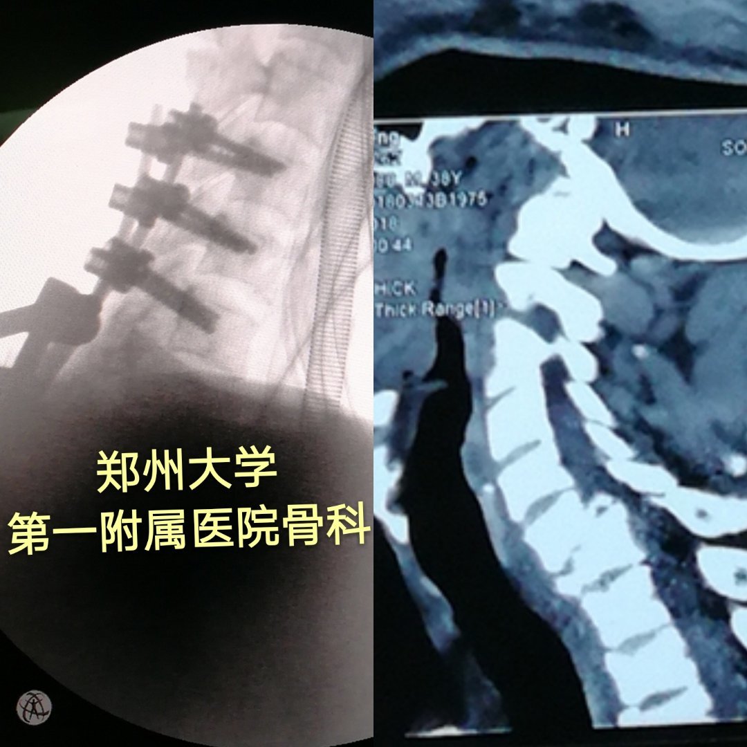 本文是娄朝晖版权所有,未经授权请勿转载.