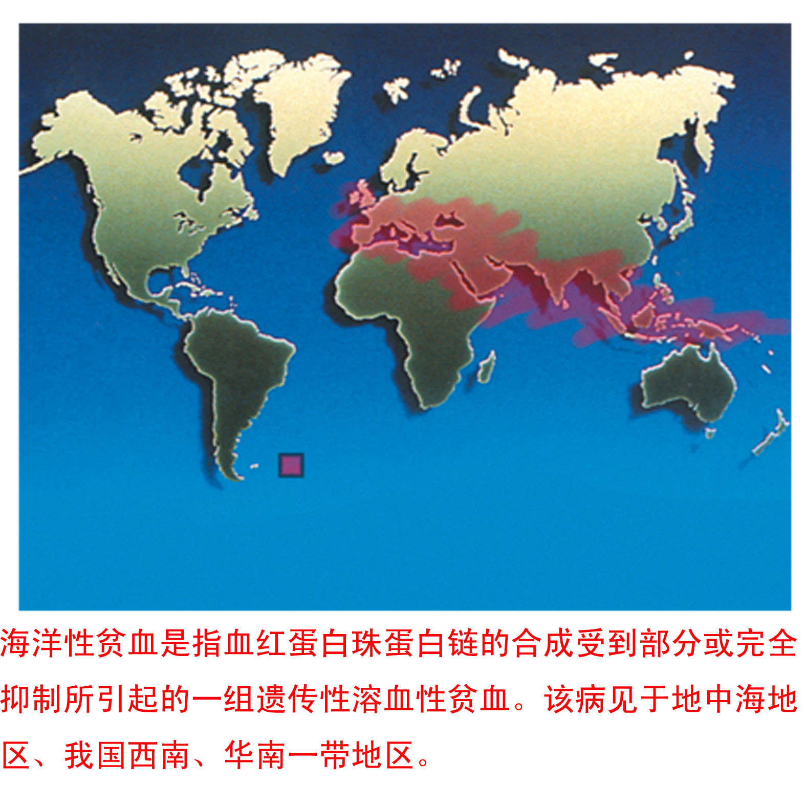 认识地中海贫血,将疾病消灭在萌芽中!