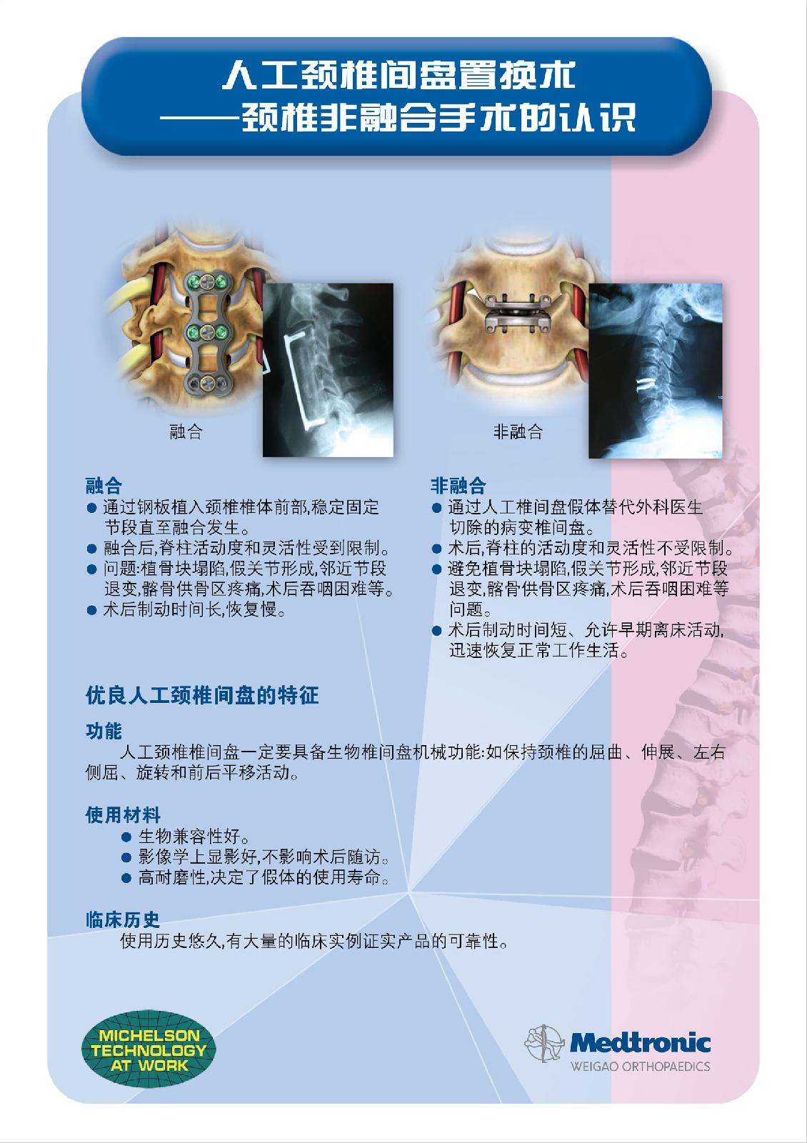 頸椎人工間盤置換術