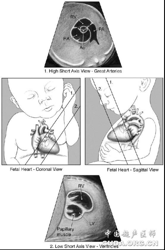 美国医学超声协会胎儿超声心动图操作指南