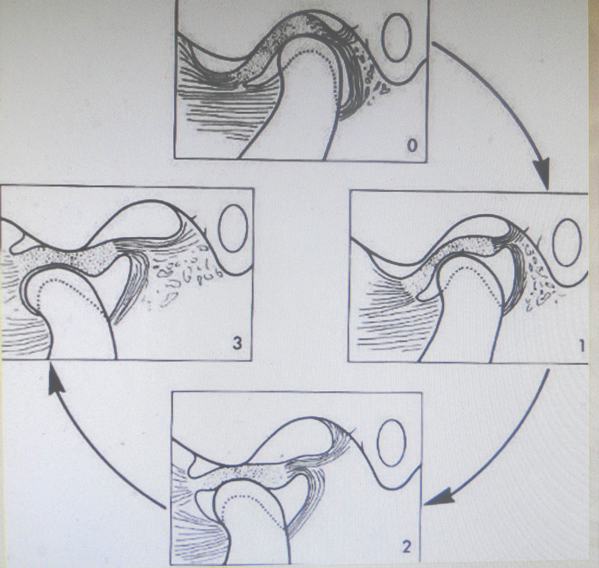 关节弹响(可复性关节盘前移位)怎么办? - 好大夫在线