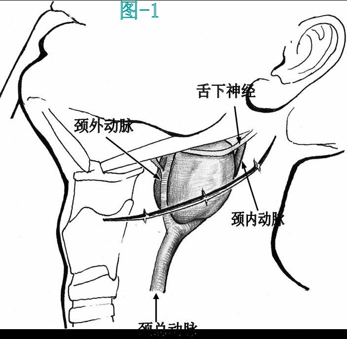 关键词:颈部肿瘤;甲状腺肿瘤;神经鞘瘤;神经节细胞瘤;颈动脉体瘤;鳃裂