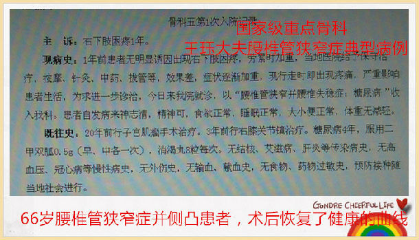 病例78 66岁腰椎管狭窄症并侧凸患者术后恢复了健康曲线